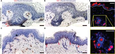 Antigen Specificity Enhances Disease Control by Tregs in Vitiligo